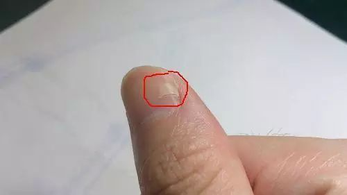 指甲有竖纹是身体什么信号？